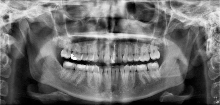 cbct-scan-cambie-marine-gateway-dental